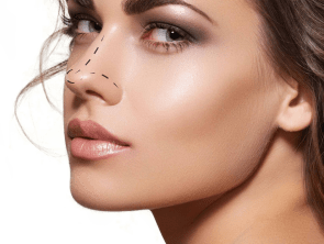 Rinoplastia