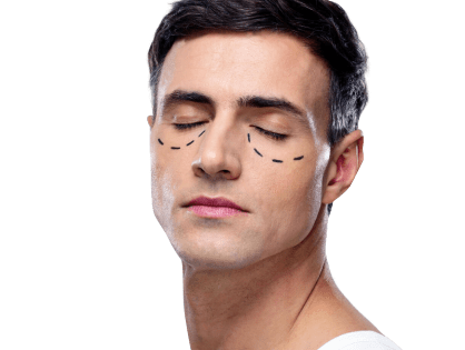 Blefaroplastia en hombres