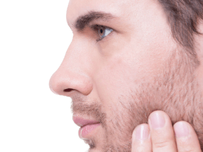 Rinoplastia en hombres