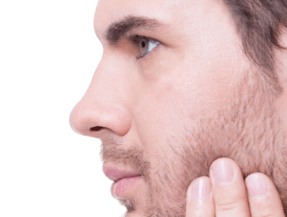 Rinoplastia en hombres